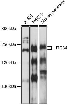 ITGB4 antibody