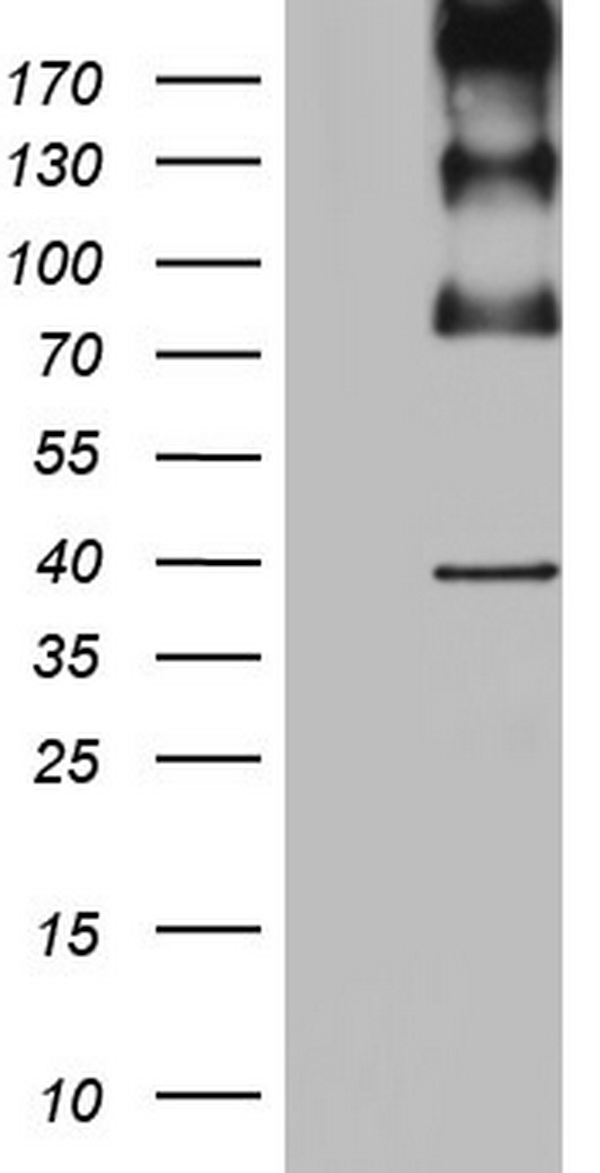 ITGB6 antibody