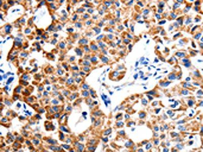 ITGB6 antibody