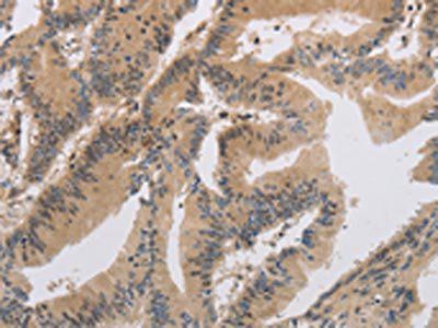 ITIH1 Antibody