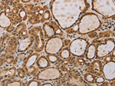 ITIH1 Antibody