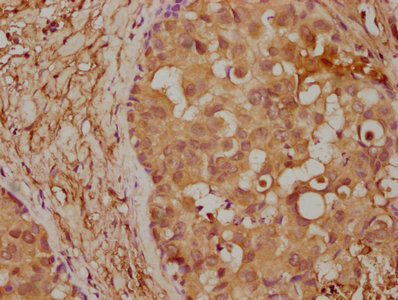 ITIH1 antibody