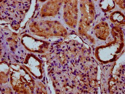 ITIH3 Antibody