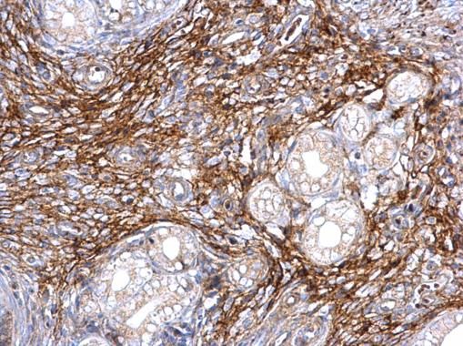 ITIH3 antibody [N1N3]