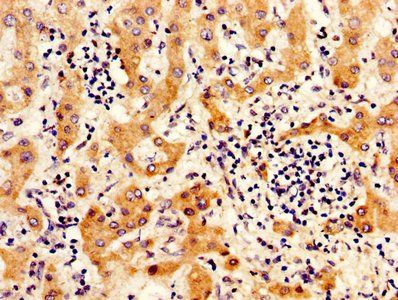 ITIH4 Antibody