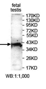 ITLN2 antibody