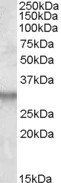 Goat anti-ITM2B Antibody