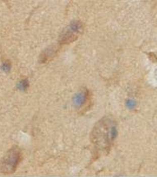 ITM2C Rabbit Polyclonal Antibody