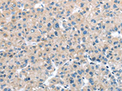 ITPA antibody