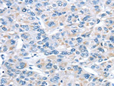 ITPA Antibody