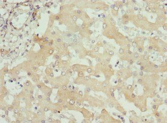ITPK1 Antibody