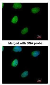 ITPK1 antibody [N3C3]