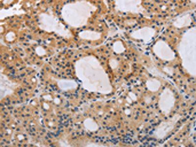 ITPR1 Antibody