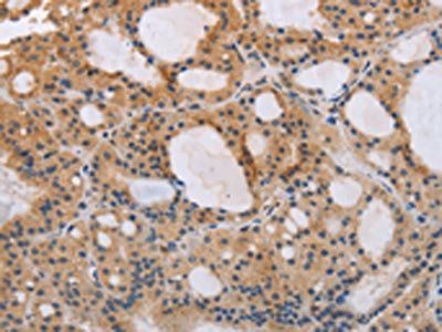 ITPR1 antibody