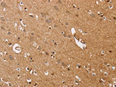 ITPR1 Antibody