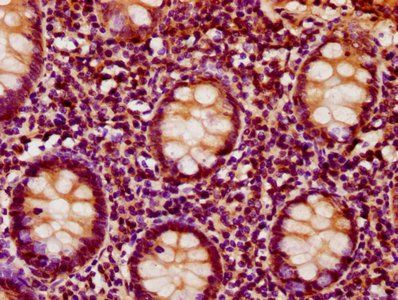 IVD Antibody