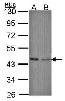 IVD antibody