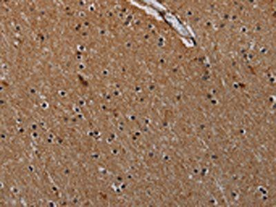 IVL Antibody