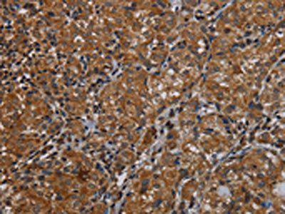 IVL Antibody