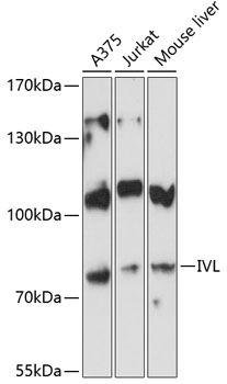 IVL antibody
