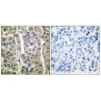 IVL Antibody