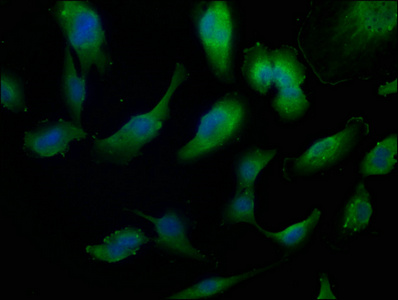 IVNS1ABP antibody