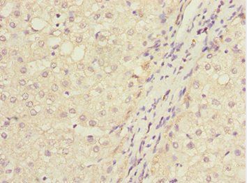 IWS1 Antibody