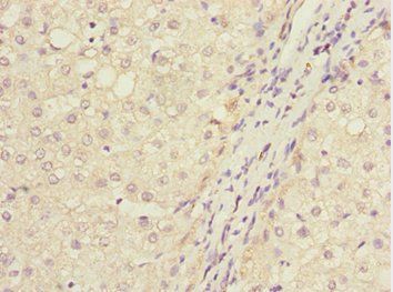 IWS1 antibody