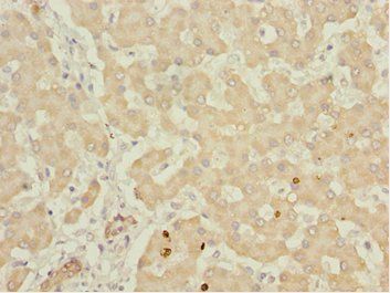 IWS1 Antibody