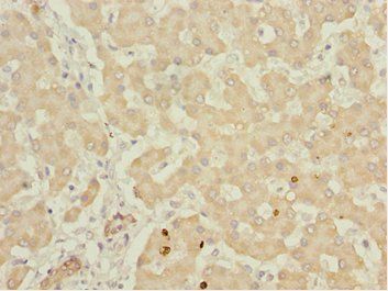 IWS1 antibody