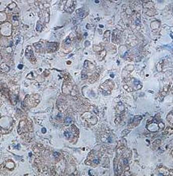 IWS1 Rabbit Polyclonal Antibody