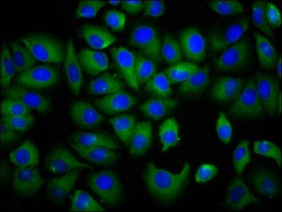 IYD Antibody