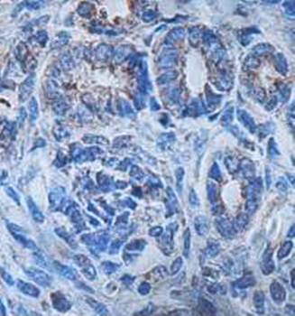 IYD Rabbit Polyclonal Antibody