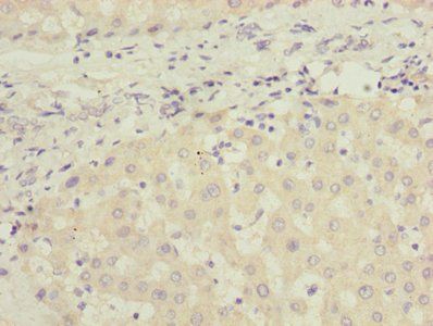 JADE1 Antibody