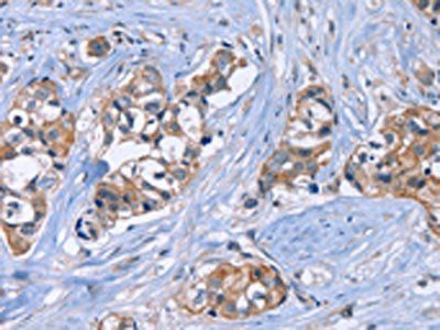 JAG1 Antibody