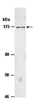 JAG1 (N) Antibody, Rabbit Polyclonal
