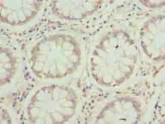 JAGN1 antibody