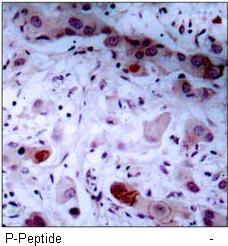 JAK1 (Phospho-Tyr1022) Antibody