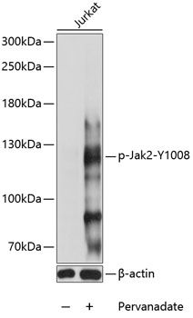 Jak2 (Phospho-Y1008) antibody