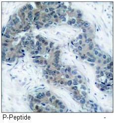 JAK2 (Phospho-Tyr1007) Antibody