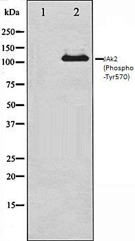 JAk2 (Phospho-Tyr570) antibody