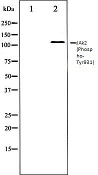 JAk2 (Phospho-Tyr931) antibody