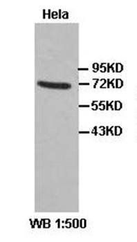JAW1 Rabbit Polyclonal Antibody