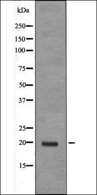 JDP-2 (Phospho-Thr148) antibody