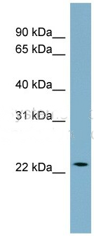 CCDC25 antibody
