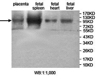 JHDM1D Rabbit Polyclonal Antibody