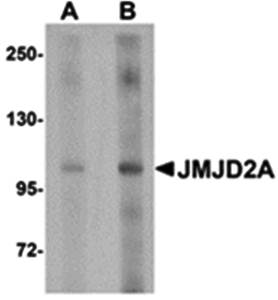 JMJD2A Antibody