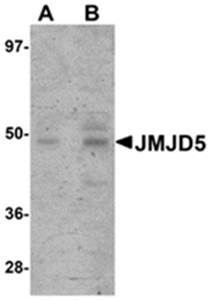 JMJD5 Antibody