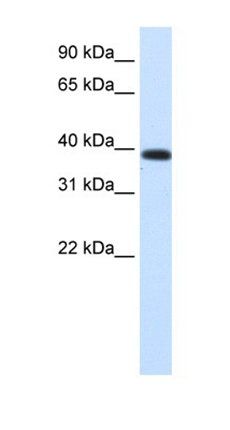 JMJD6 antibody