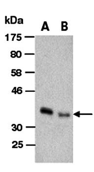 JMJD7 antibody